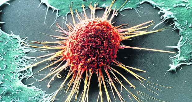 cancer cell image